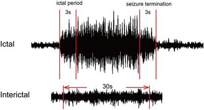 Frequency-Dependent Dynamics of Functional Connectivity Networks During Seizure Termination in Childhood Absence Epilepsy: A Magnetoencephalography Study